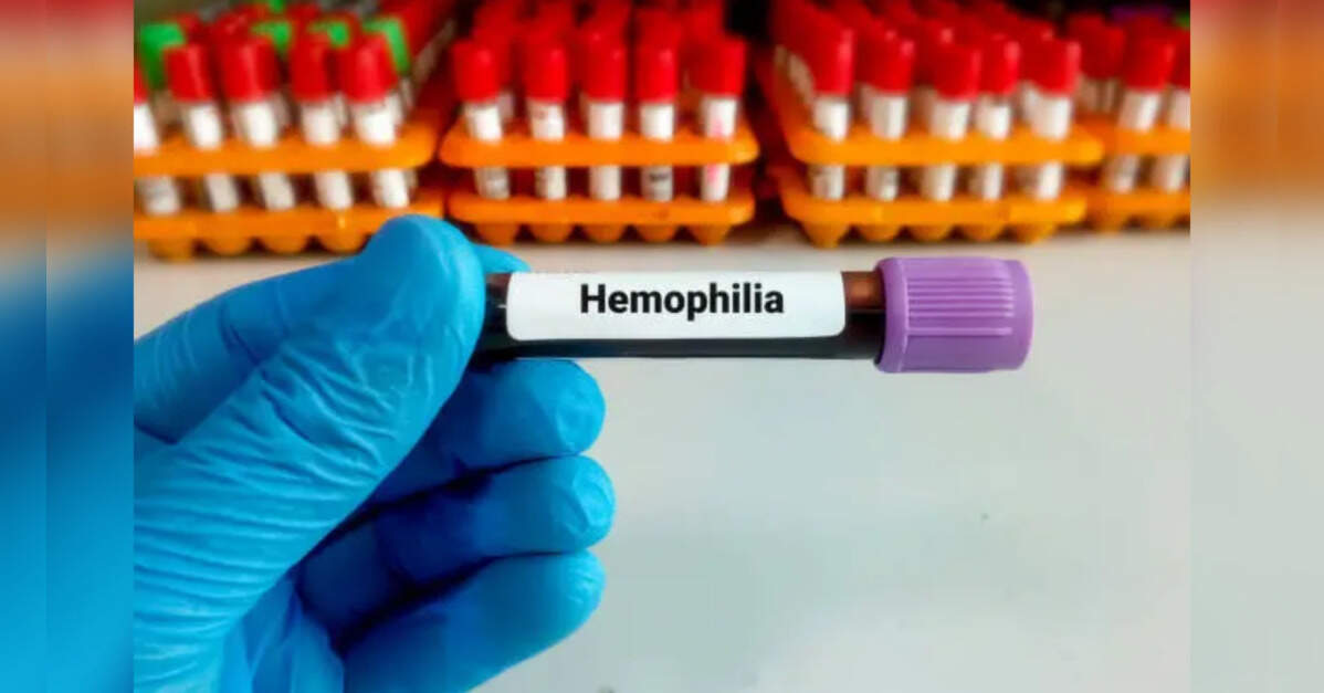 Experts urge standard treatment guidelines to streamline haemophilia care in India