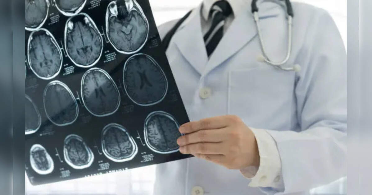 White matter damage can trigger neurodegeneration-like features, study suggests