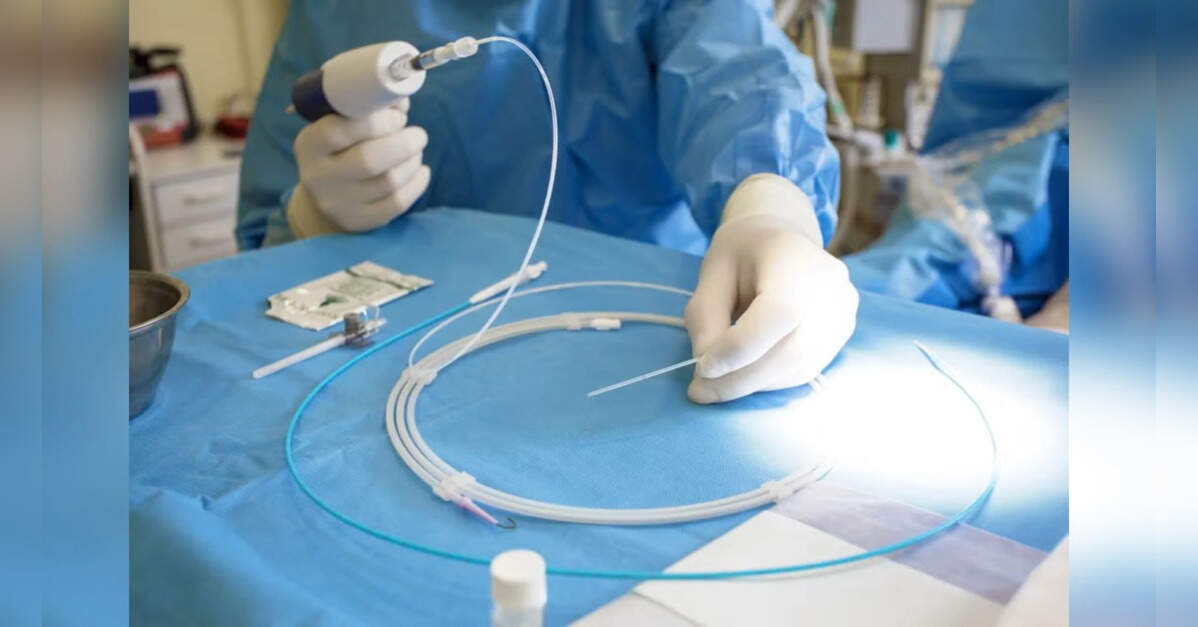 Procedure to treat type 2 diabetes helps keep off weight after patients stop GLP-1 drugs