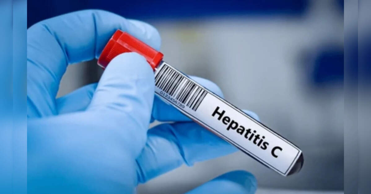 World going too slow on eliminating hepatitis: WHO