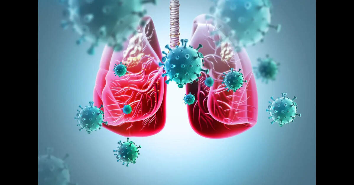 Nutritional Support for TB Patients Could Save Over 120,000 Lives ...