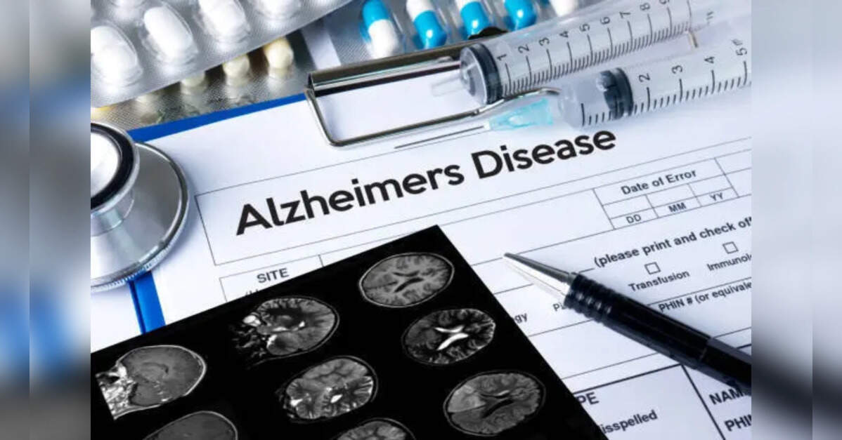 Alzheimer’s Lormalzi therapy offers hope; doctors for early diagnosis, close monitoring