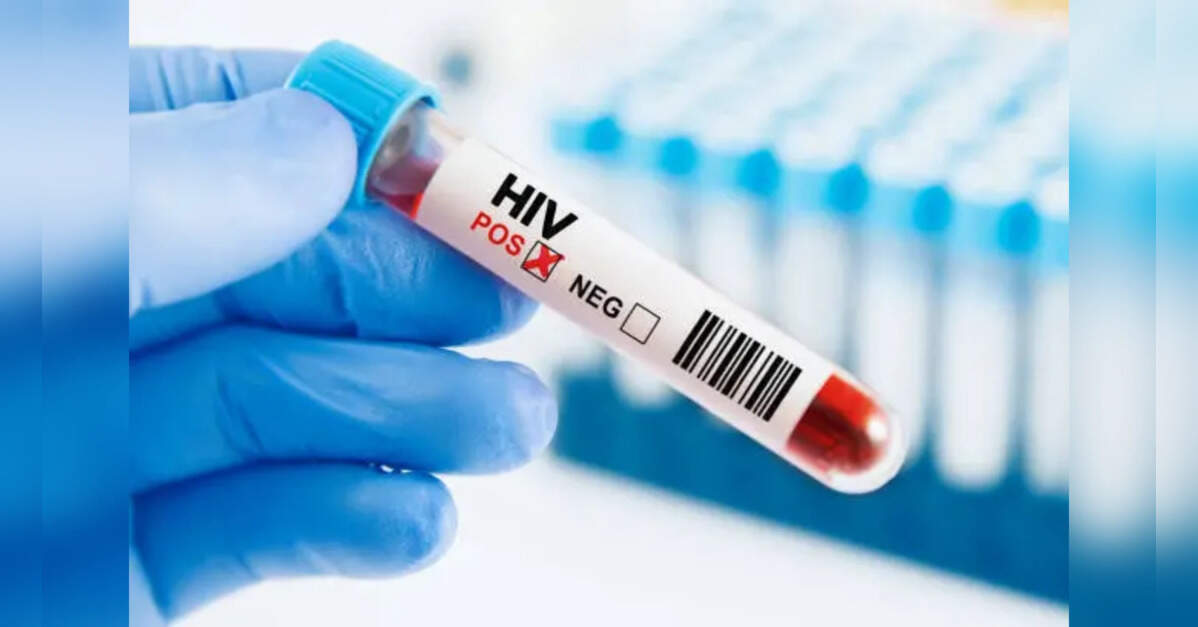 Fight against HIV 'in peril' due to aid cuts, UN warns