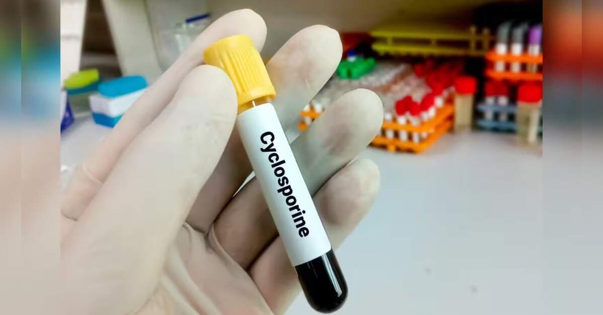 Cyclosporiasis Outbreak Highlights Flaws in US Public Health System, ETHealthworld