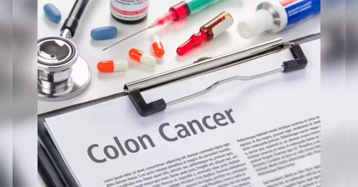Appendix removal linked with lower colon cancer risk in study