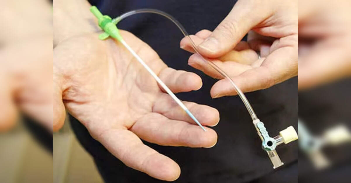 Health ministry asked to examine coronary stent safety concerns