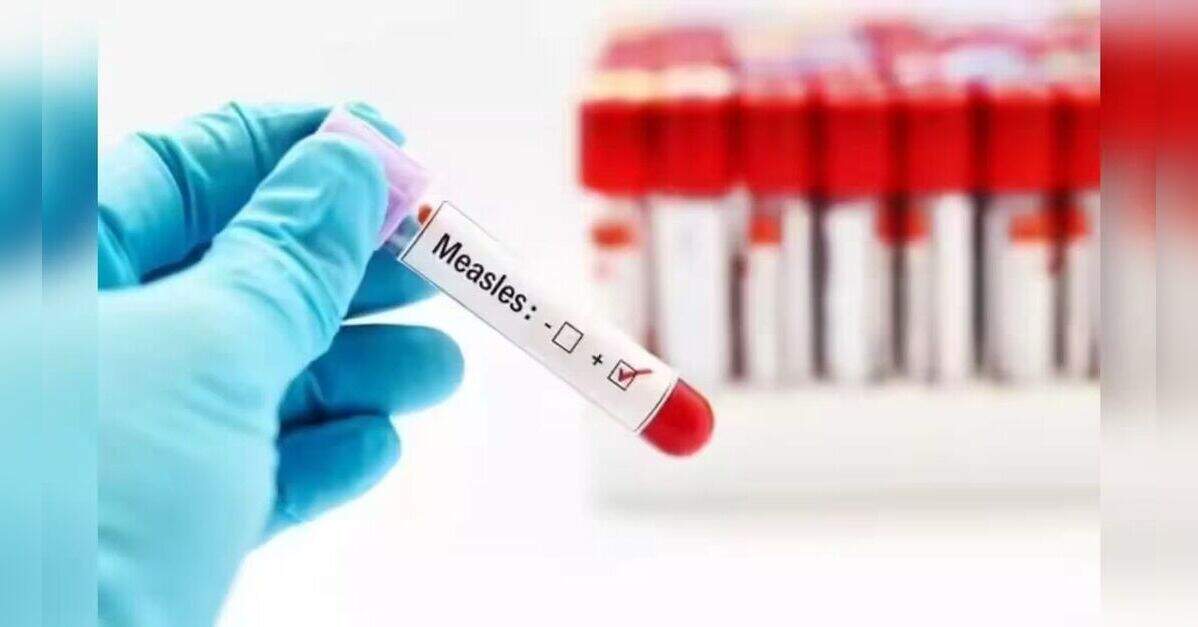 Measles Outbreak in Pennsylvania Surges to 1,317 Cases Amid State ...