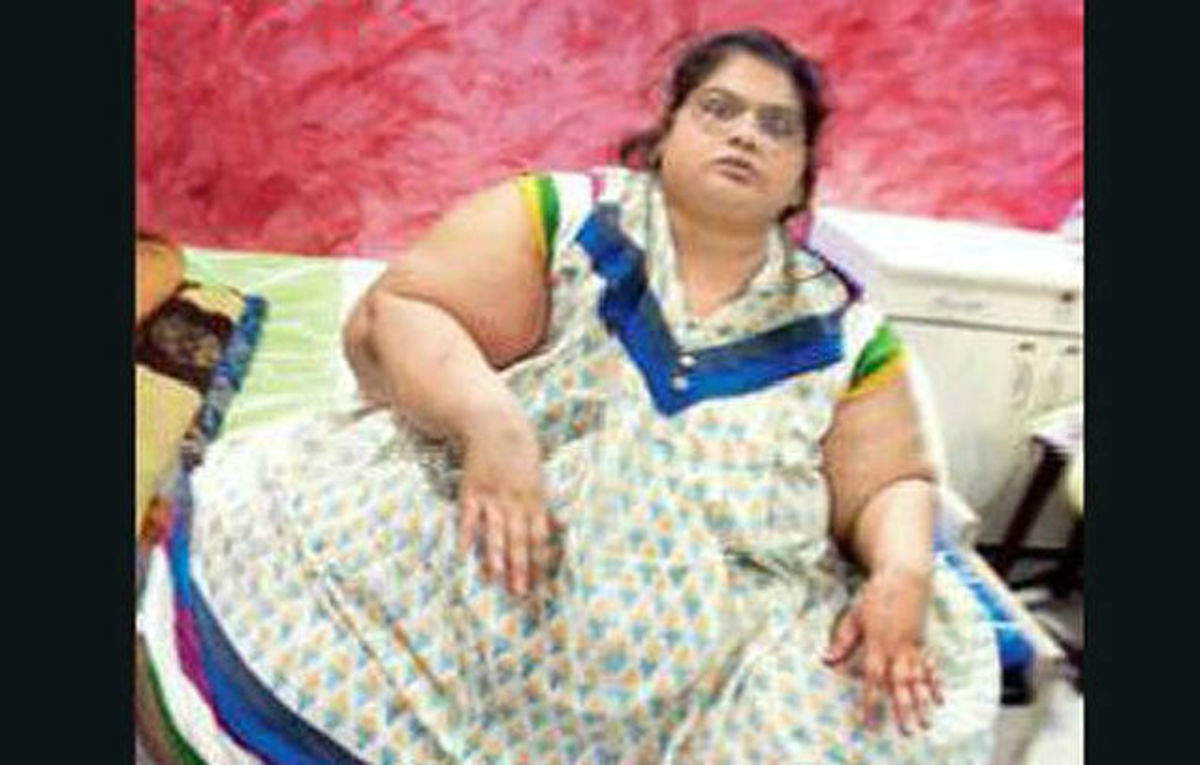 300kg Mumbai woman loses 117kg post bariatric surgery, Health News, ET ...