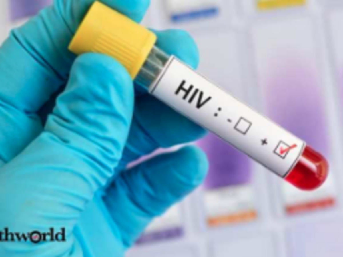 Image result for Second HIV Remission Patient Rekindles Hope Of Cure