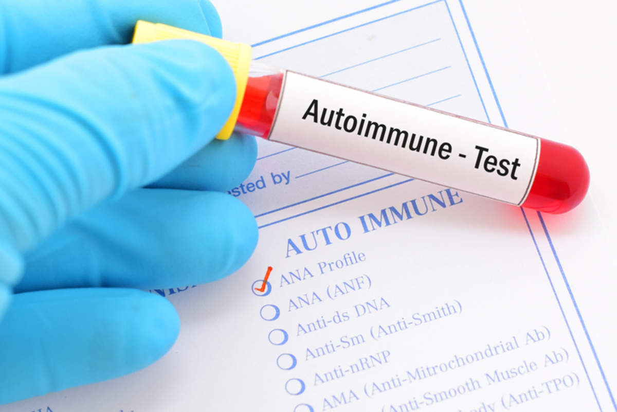 autoimmune disease: Auto-immune diseases on rise among women of  reproductive age: Experts, Health News, ET HealthWorld