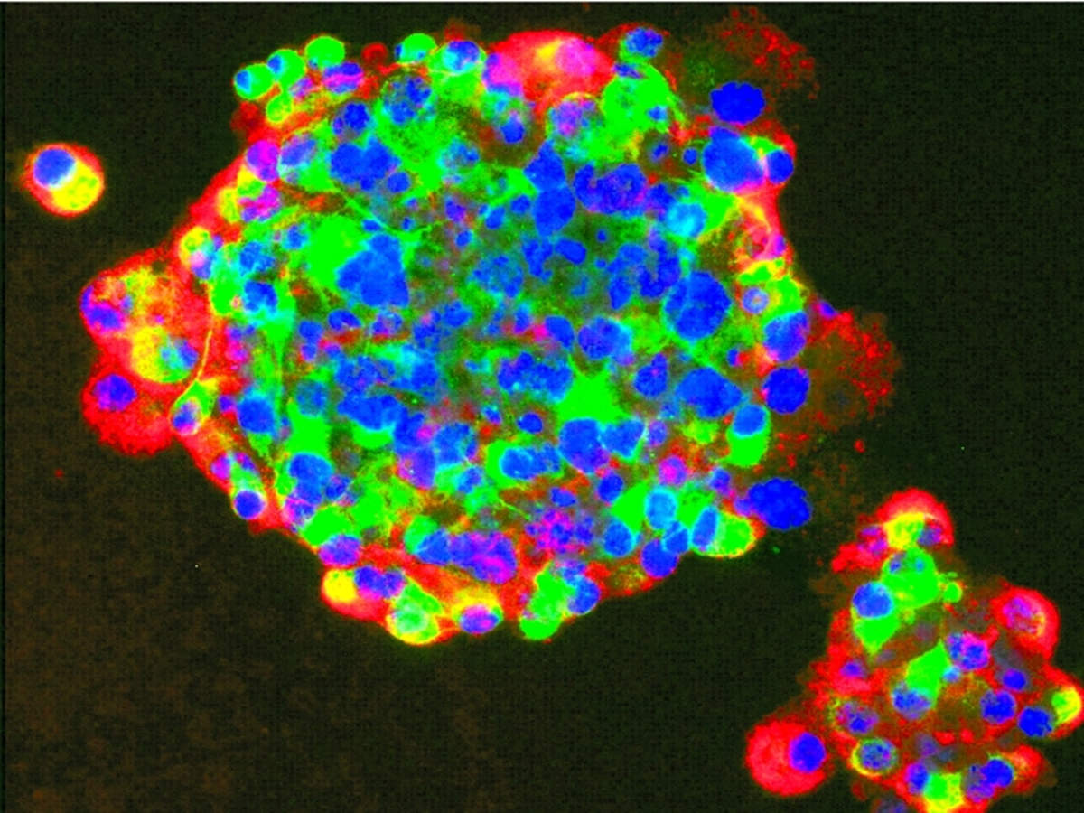 Scanning electron microscopy of human islet cilia