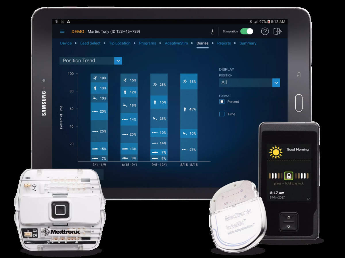 Medtronic's Intellis spinal cord stimulator algorithm delivers