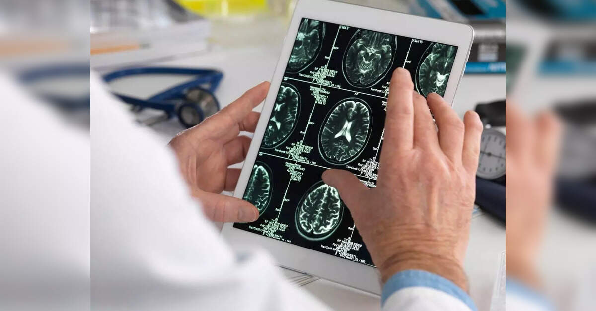 New study explores why brain cancer returns, ETHealthworld