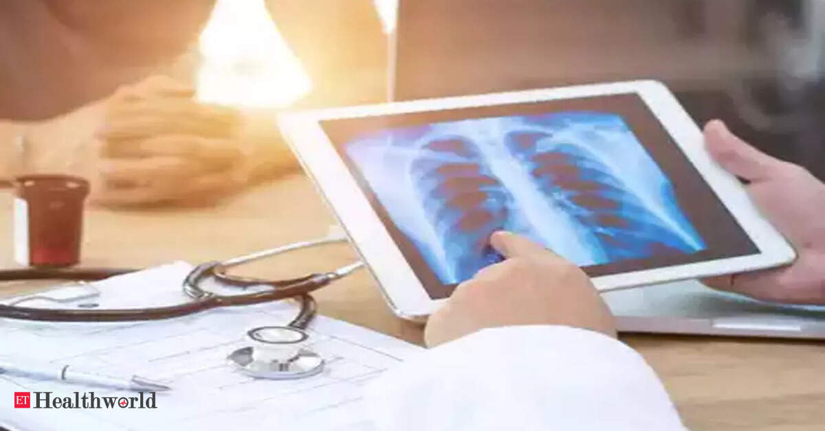 Long Covid Researchers detect longCovid's impact via simple chest X