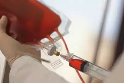 Labgrown Blood Labgrown blood given to people in worldfirst clinical trial, Health News, ET