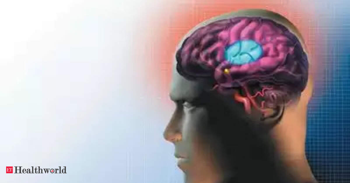 AI-powered technology sees big improvements in UK stroke treatment: analysis, Health News, ET HealthWorld