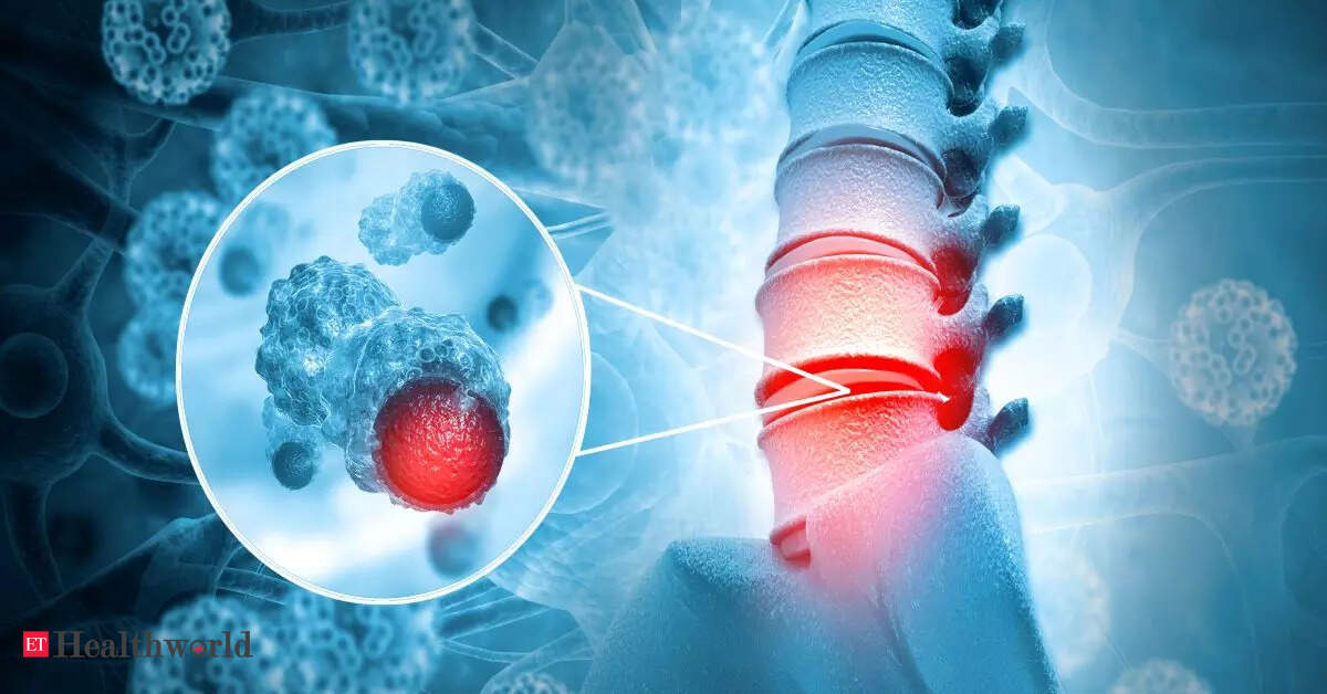 Alarming rise of spinal problems in India: Minimally Invasive Surgery ...